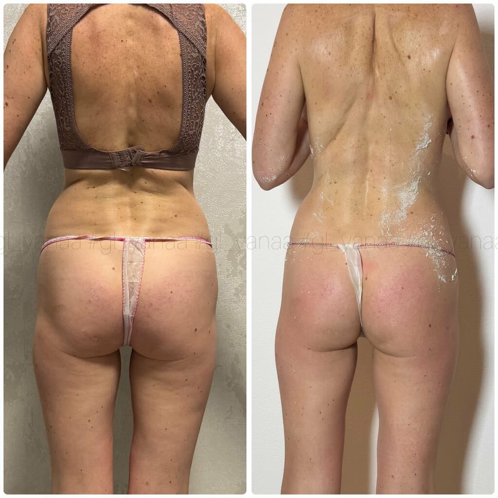 Салон красоты Я на массаж!