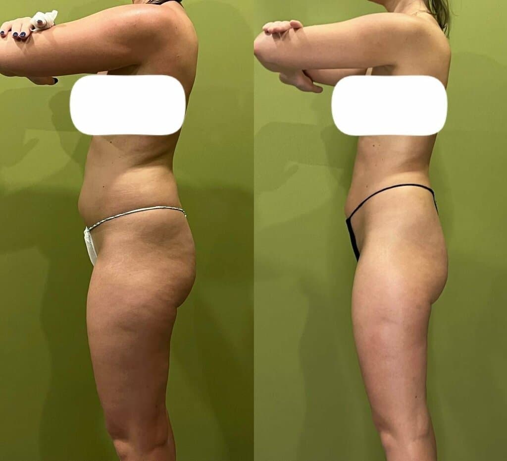 Салон красоты Лайм студия коррекции фигуры