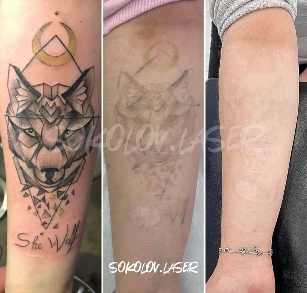 Салон красоты Sokolov Laser